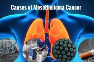 What Causes Mesothelioma | Asbestos Exposure and Silicate Minerals